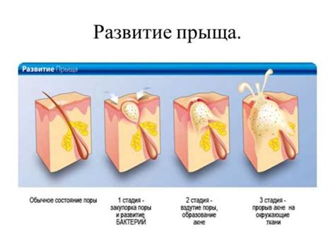 Основные причины появления прыщей на носу