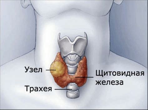 Основные причины увеличения щитовидной железы