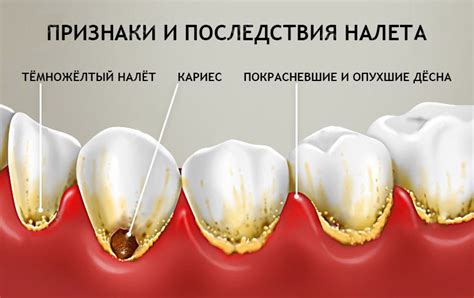 Особенности интерпретации снов, связанных с зубной налетом