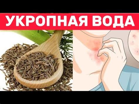 Особенности использования укропной воды в режиме сна