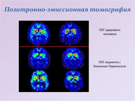 Ошибки, связанные с интерпретацией сновидений у человека с психическим расстройством