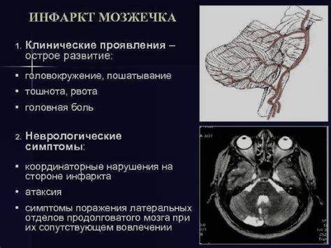 Патологии мозжечка: симптомы и последствия