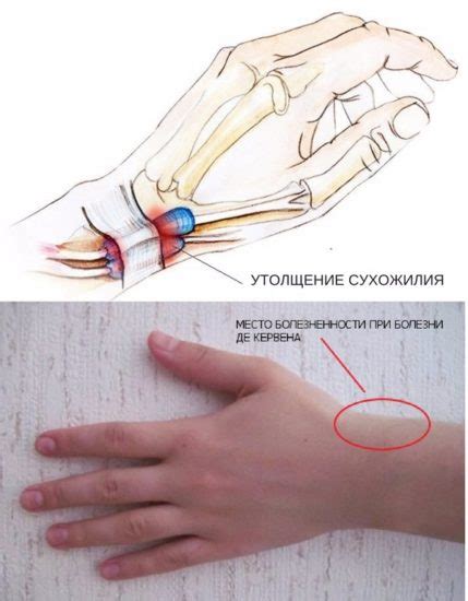 Пластическая хирургия в коррекции формы пальцев