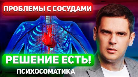 Плоскостопие и проблемы с сосудами