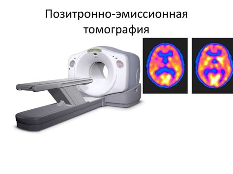 Плюсы и минусы использования магнитно-резонансной томографии