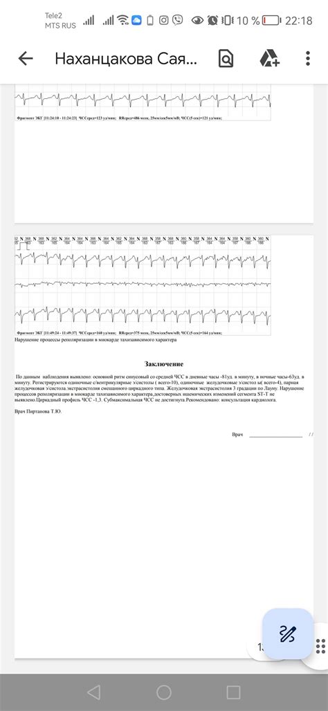 Повышение давления и пульса при приеме антибиотиков