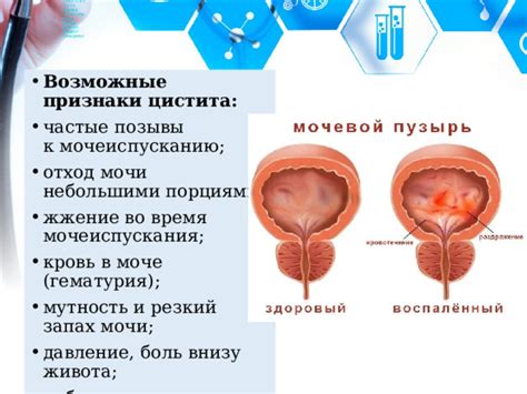 Повышение частоты мочеиспускания