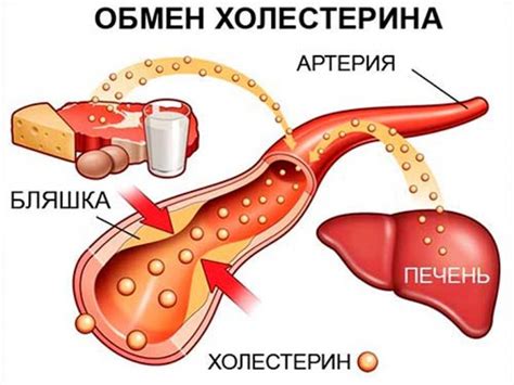 Повышенное содержание холестерина