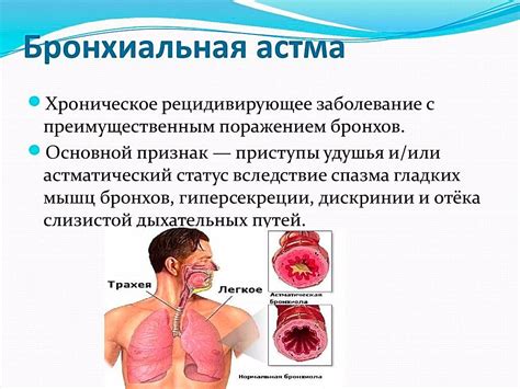 Понятие астмы и ее причины