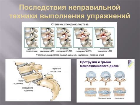 Последствия неправильной техники выполнения