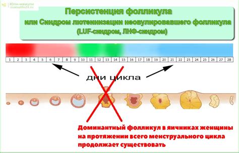 Потенциальные последствия разрыва фолликула перед пункцией