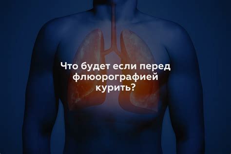 Потенциальные риски парения перед флюорографией