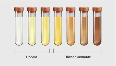 Почему моча окрашивается в коричневый цвет после чая?