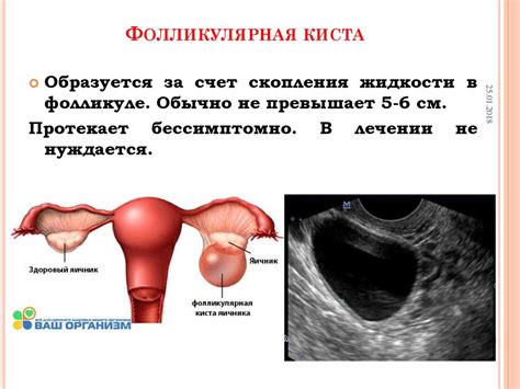 Почему у женщин два яичника?