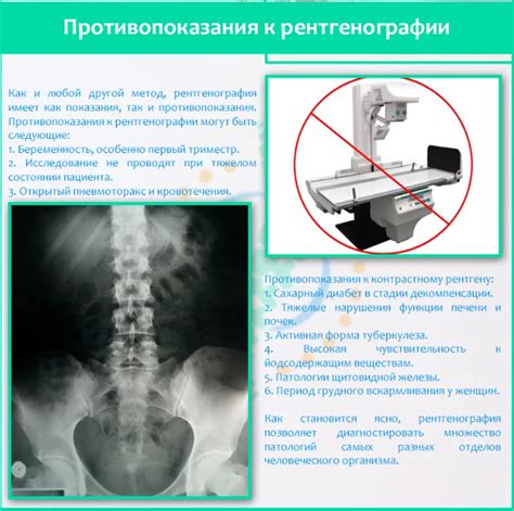 Правила питья перед рентгеном позвоночника