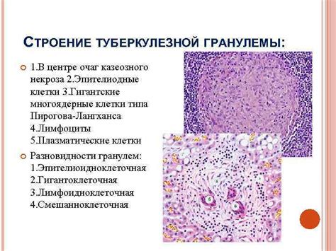 Предотвращение образования гранулем