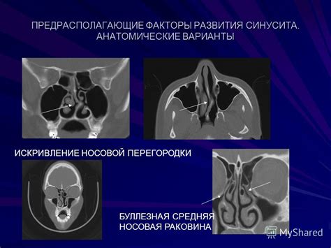 Предрасполагающие факторы появления узлов