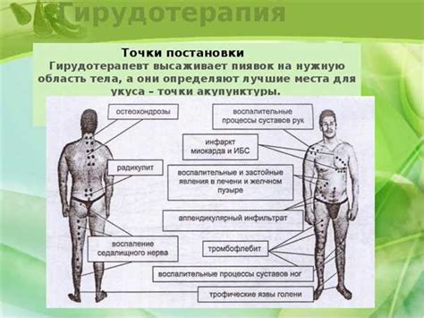 Предыстория использования пиявок в медицине