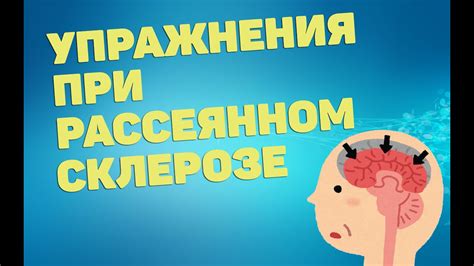 Преимущества электрофореза при рассеянном склерозе