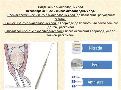 Признаки подтекания околоплодных вод