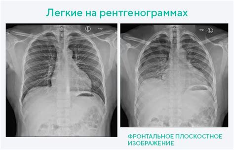 Применение стекла на рентгене в диагностике и лечении