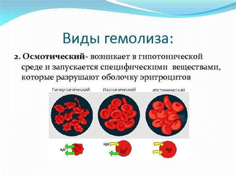 Причины гемолиза в биоматериале