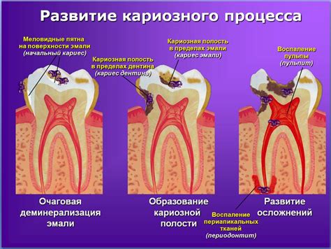 Причины и истолкование выпадения зуба с примесью крови