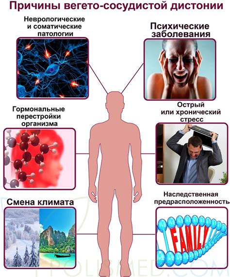 Причины и симптомы вегето-сосудистой дистонии