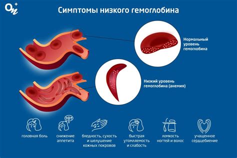 Причины низкого уровня гемоглобина