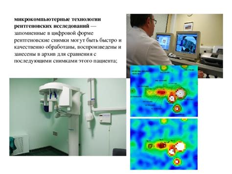 Причины ограничений для рентгеновских исследований