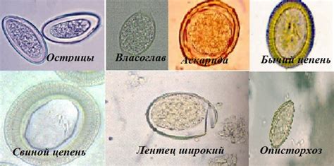 Пути передачи глистов