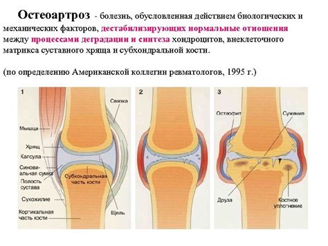 Развивающиеся заболевания суставов