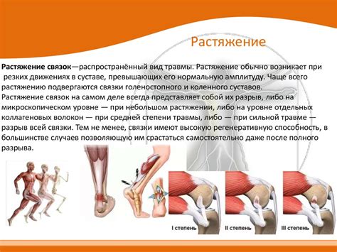 Растяжение связок: причины и распространенные последствия