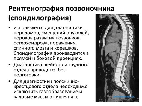 Рекомендации по питью перед рентгеном позвоночника