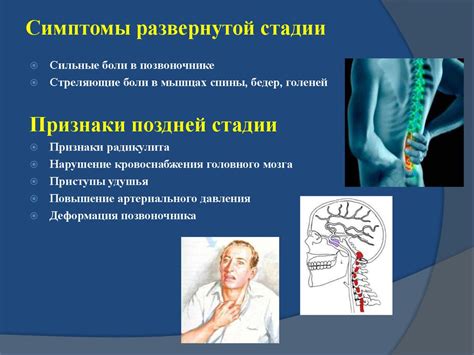 Риски и выгоды бега при болезни Бехтерева