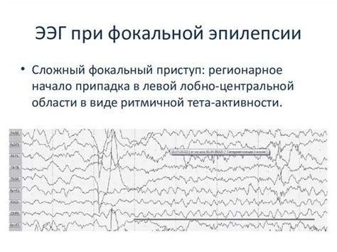 Роль чистоты в проведении электроэнцефалографии