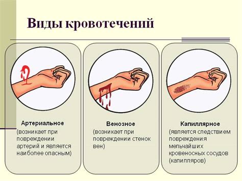 Связь сновидения о кровотечении на ногах с состоянием физического благополучия