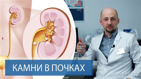 Симптомы, которые могут быть связаны с наличием песчаных образований в почках у женщин: