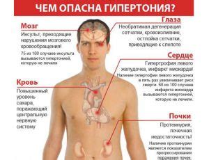 Симптомы гипертонии у подростка