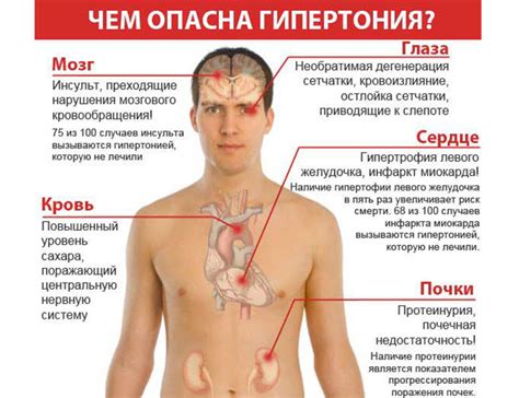 Симптомы гипертонии у подростков