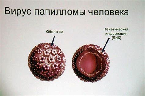 Симптомы и причины образования папиллом