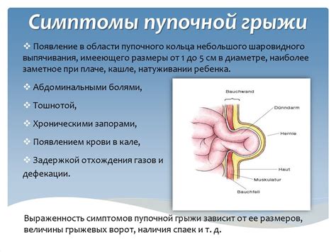 Симптомы пупочной грыжи