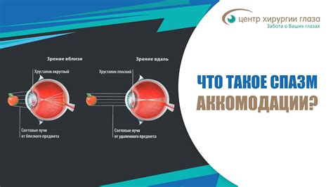 Снижение уровня усталости глаз и повышение комфорта