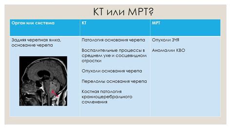 Сравнение КТ и других методов диагностики у детей 4 лет