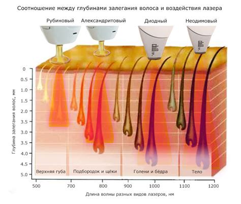 Сравнение методов удаления волос на ляшках: что выбрать?