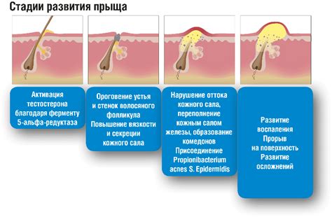 Сравнение разных методов омовения прыща