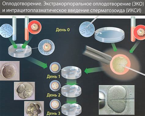 Техники искусственного оплодотворения