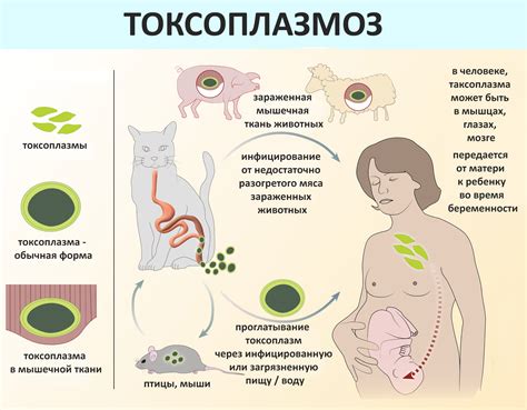 Токсоплазмоз