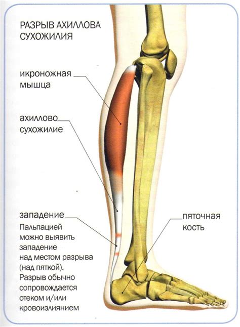 Травмы и заболевания сухожилий