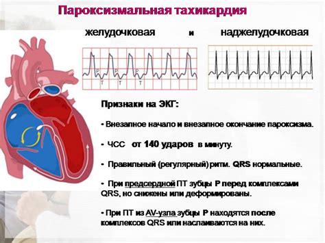 Тренировочные преимущества бокса при тахикардии